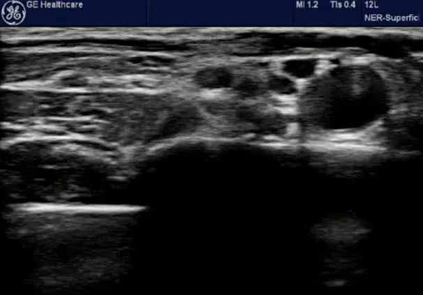 ultrasound image ultrasound image